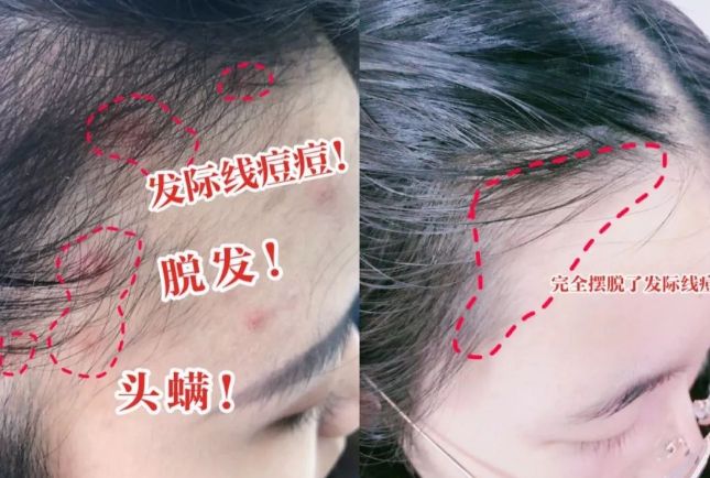 好？10分钟轻松养成女明星「绸缎发」澳门新葡京入口洗完头自然风干还是吹干(图19)